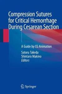 Bokomslag for "Compression Sutures for Critical Hemorrhage During Cesarean Section"