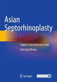 Asian Septorhinoplasty