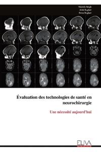 Évaluation des technologies de santé en neurochirurgie