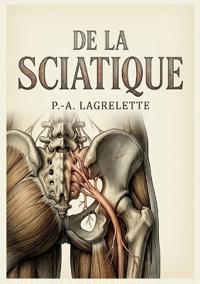 De la sciatique