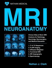 MRI NEUROANATOMY