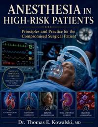 Anesthesia in High-Risk Patients