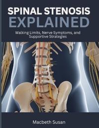 Spinal Stenosis Explained
