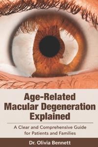 Age-Related Macular Degeneration Explained