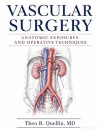 Vascular Surgery