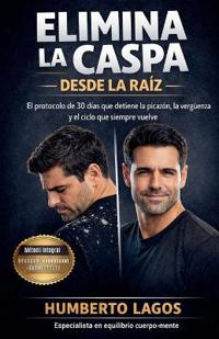 Elimina La Caspa Desde La Raíz