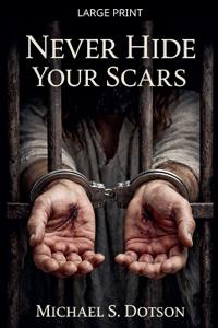 Never Hide Your Scars