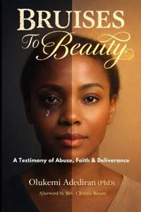 Bruises to Beauty