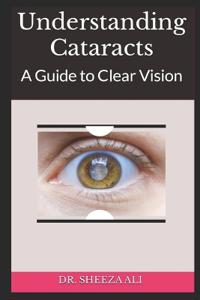 Understanding Cataracts