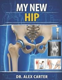 My New Hip