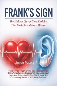 Peters, J: Frank's Sign