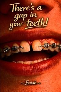 There's a gap in your teeth!