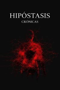 Hipóstasis