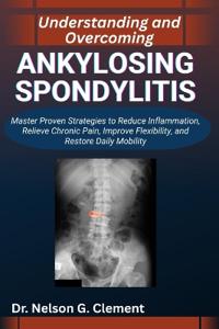 Understanding and Overcoming Ankylosing Spondylitis