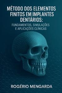Método DOS Elementos Finitos Em Implantes Dentários
