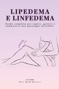 Lipedema e Linfedema