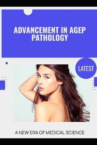 Advancement in AGEP Pathology