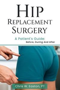 Hip Replacement Surgery