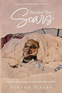 Beyond The Scars