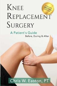 Knee Replacement Surgery, A Patient's Guide