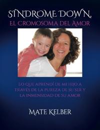 SÍNDROME DOWN El Cromosoma del Amor