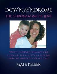 Bokomslag för "DOWN SYNDROME The Chromosome of Love"