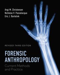 Forensic Anthropology