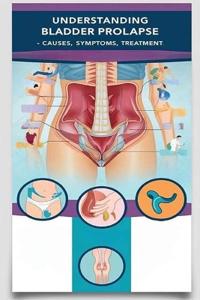 Understanding Bladder Prolapse - Causes, Symptoms, Treatment