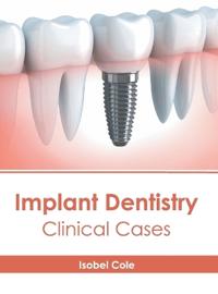 Implant Dentistry: Clinical Cases
