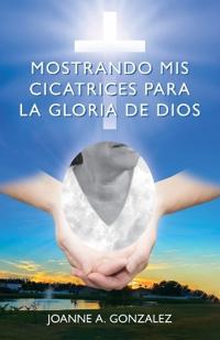 Mostrando mis cicatrices para la Gloria de Dios
