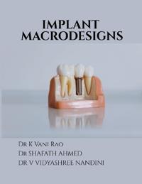 Implant Macrodesigns