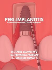 Peri-Implantitis