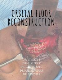 Orbital floor reconstruction