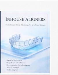 Inhouse aligner
