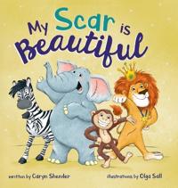 My Scar is Beautiful