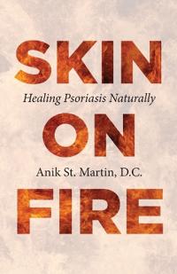 Skin on Fire